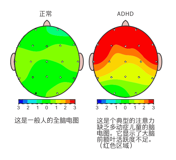 南京八岁孩子记忆力差